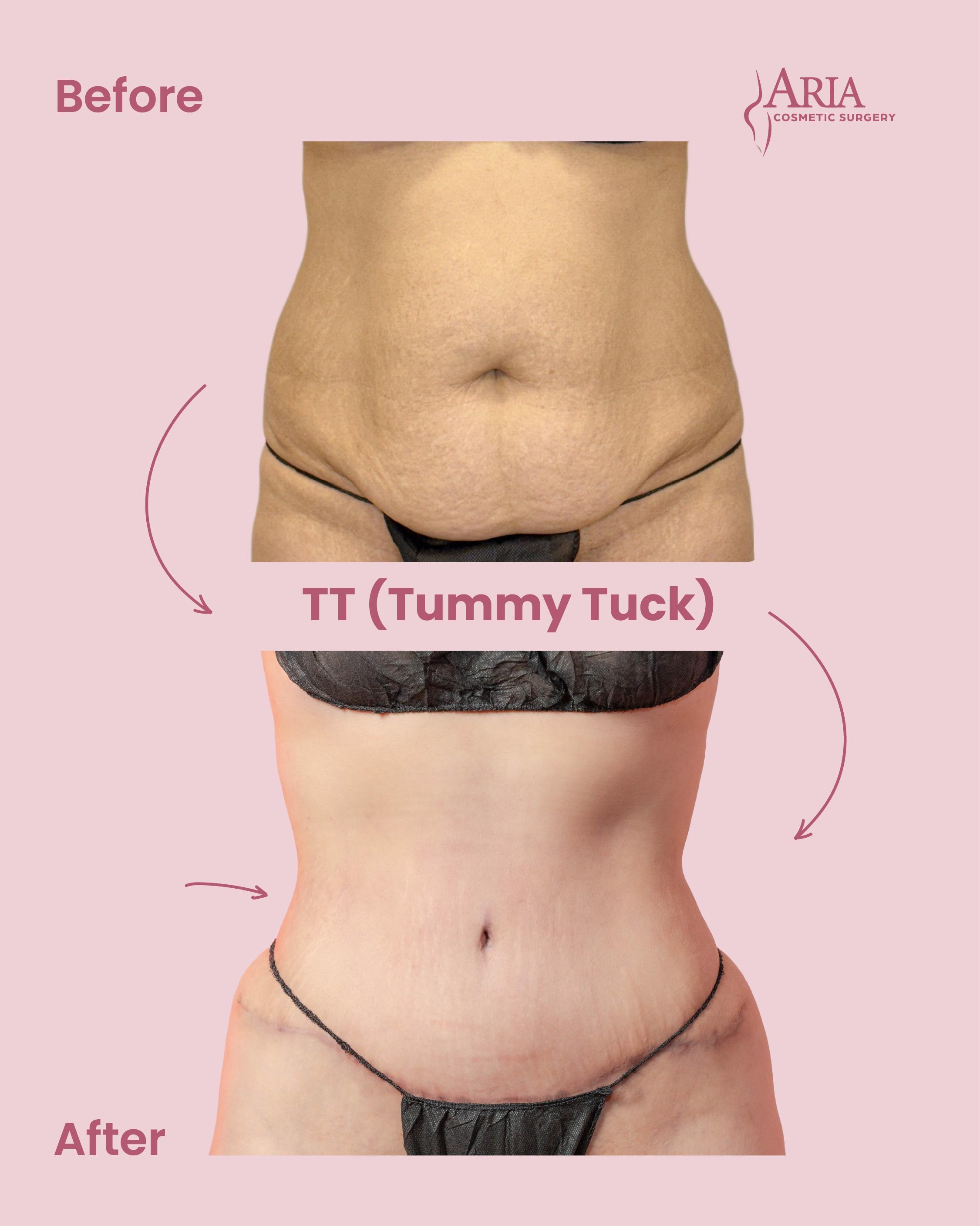 Aria Cosmetic Surgery Image