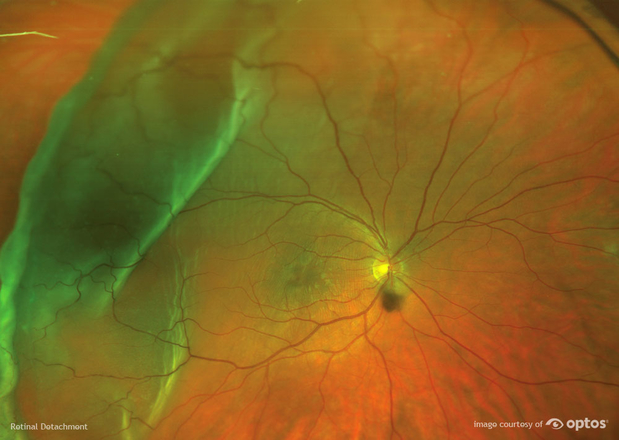 Images Cascade Vision Center