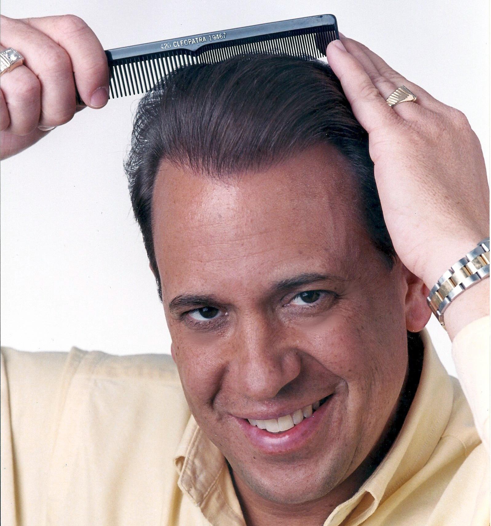 Hair Transplant Specialists Photo