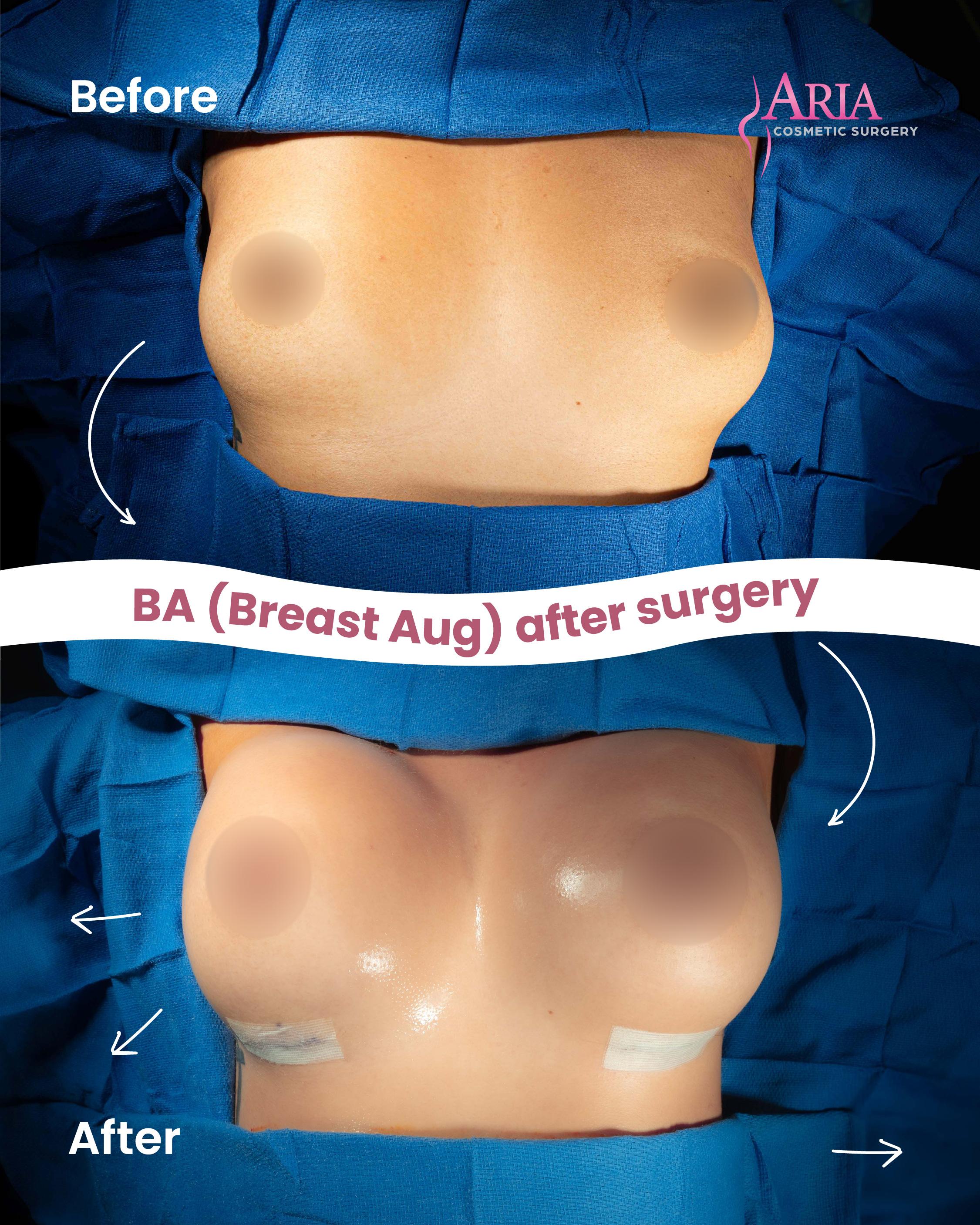 Aria Cosmetic Surgery Image