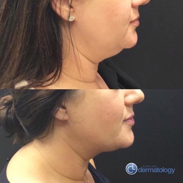 Images Clear Lake Dermatology