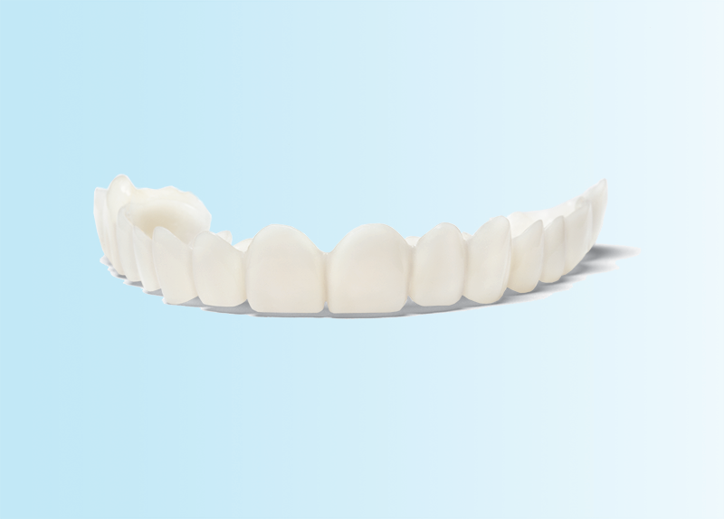 Snap-On Smile
