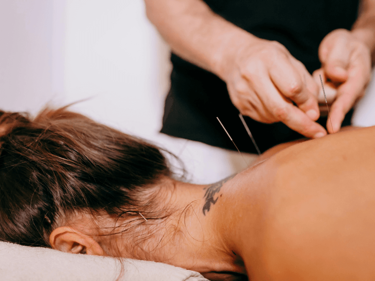 Acupuncture - Isabelle Deblois