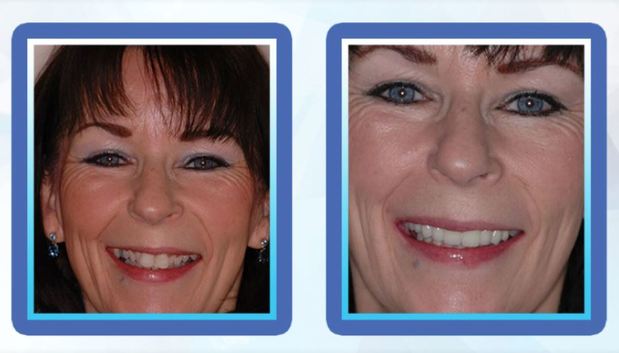 Images Max L Lingo, DDS