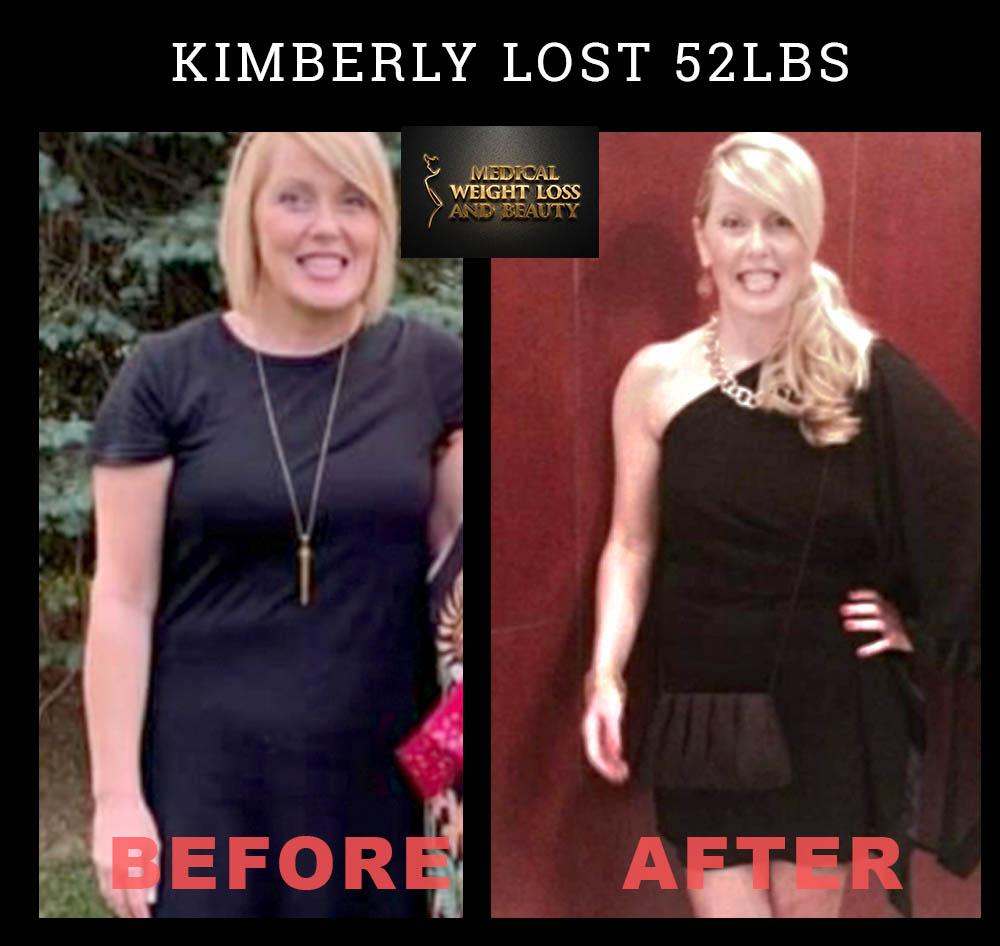 Medical Weight Loss and Beauty Image