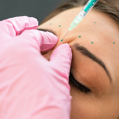 RN Esthetics is among the top providers of BOTOXÂ® + DysportÂ® in the nation. We use a conservative approach to treatment. Our team does not subscribe to the frozen look, but rather treat to strategically soften areas of the face for a natural result.