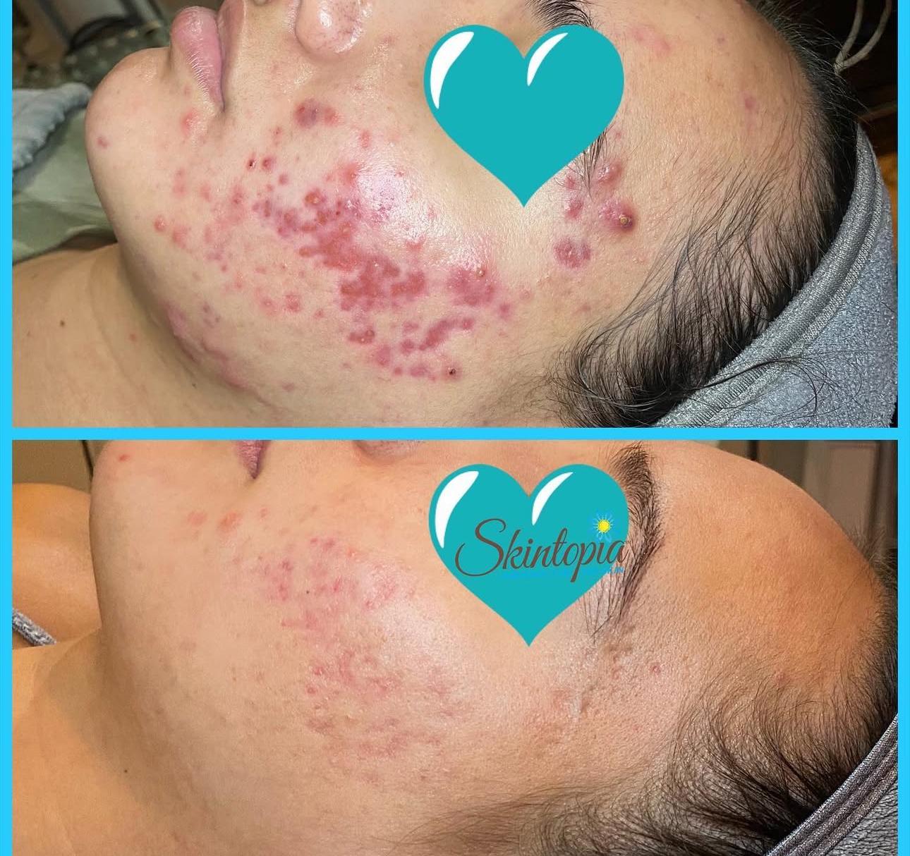 Skintopia
