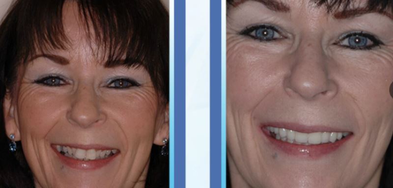 Images Max L Lingo, DDS