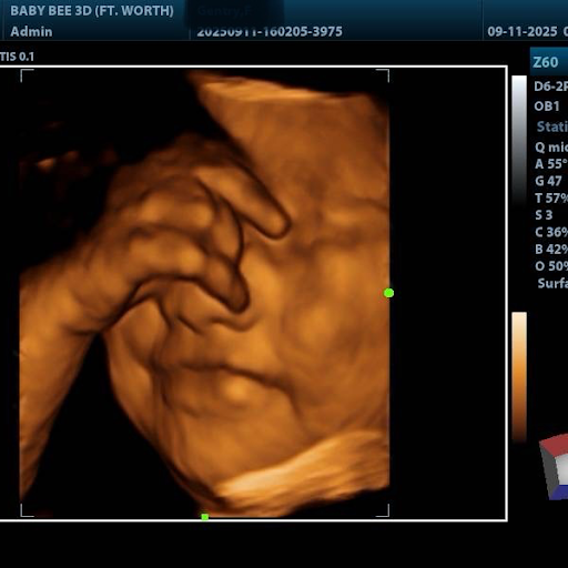 Baby Bee 3D Ultrasound + Photography Studio (Arlington)
