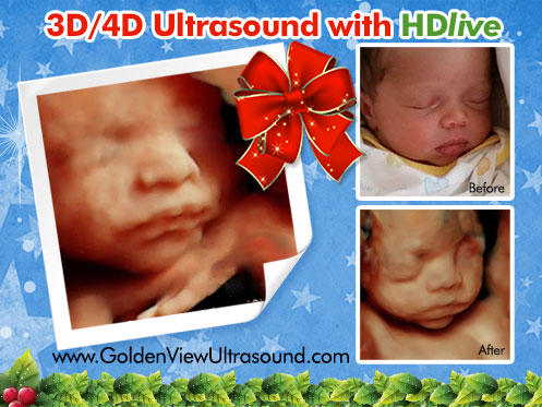 Goldenview Ultrasound 3d/4d/HD Boston MA Photo