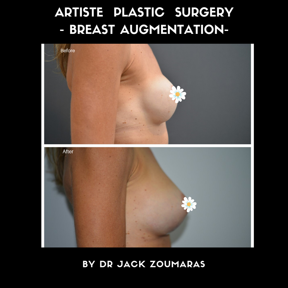 Images Artiste Plastic Surgery - Dr. Jack Zoumaras