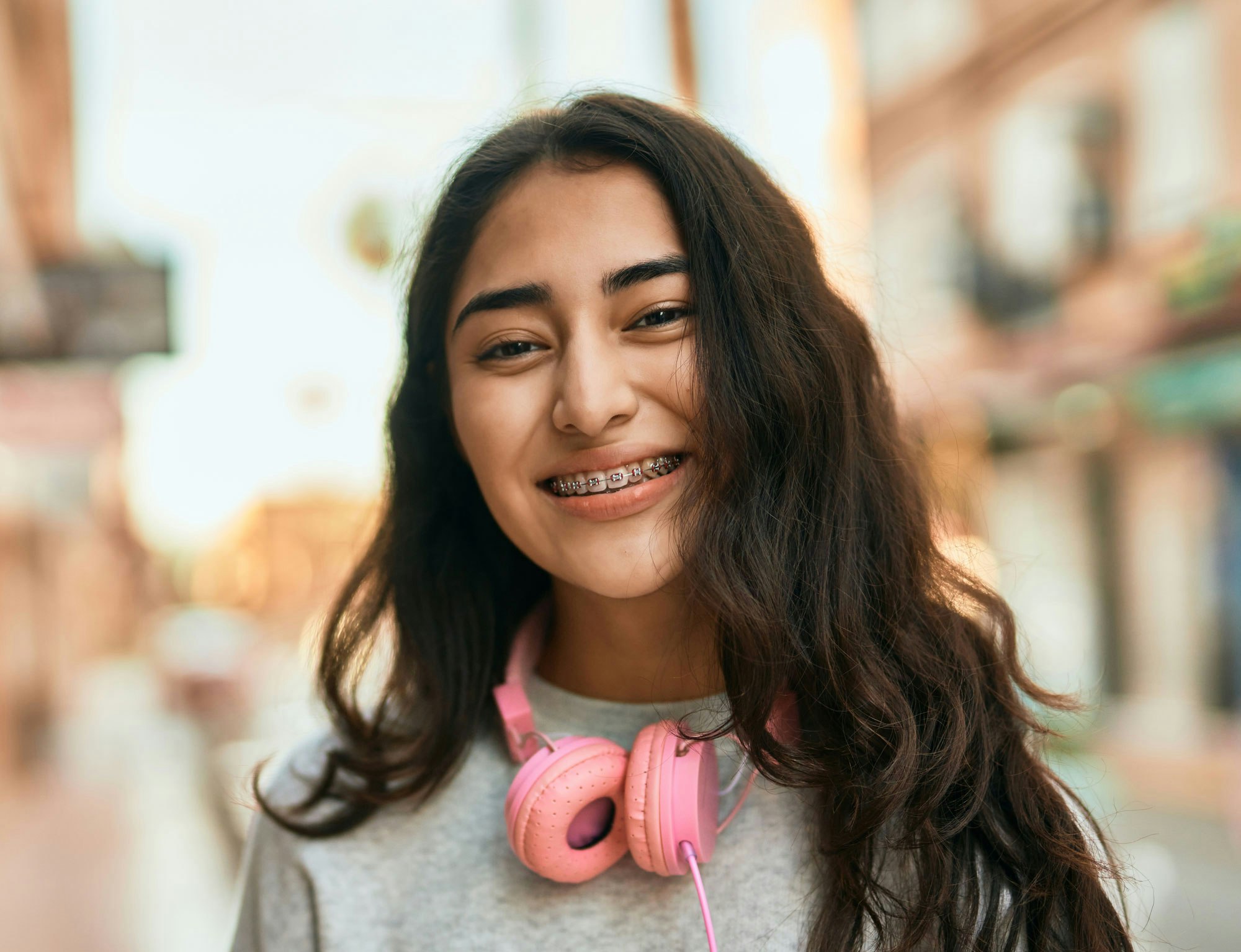 Traditional Braces