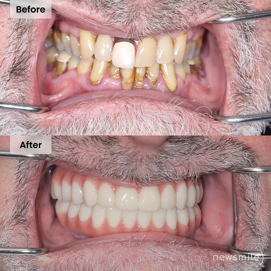 New Smile Columbus Dental Implant Studio Image