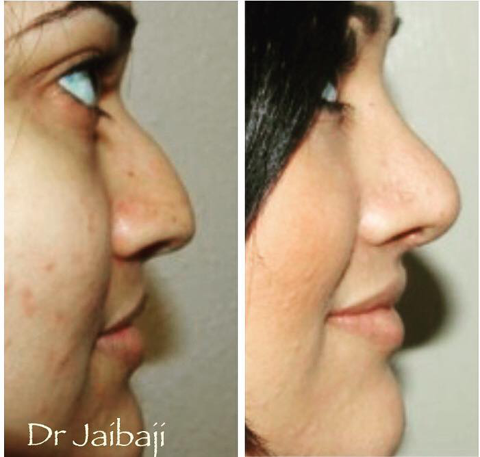 Jaibaji Plastic Surgery Photo