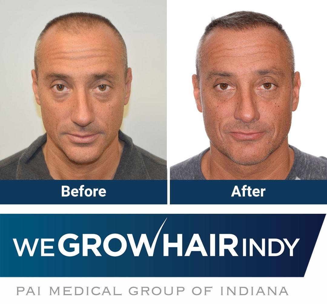 We Grow Hair Indy Photo