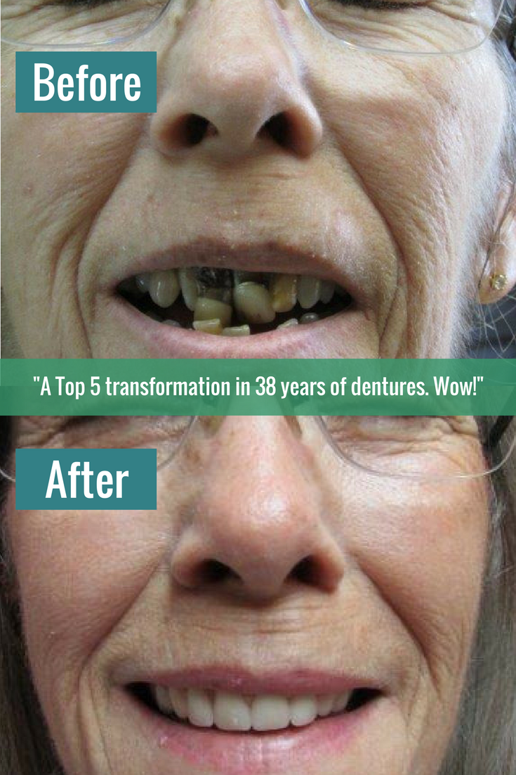 Advanced Denture Care and Lab Photo