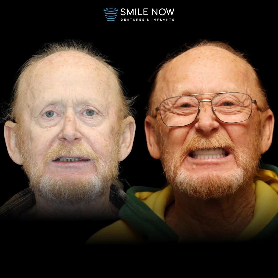 Smile Now Boise Dentures and Implants Image