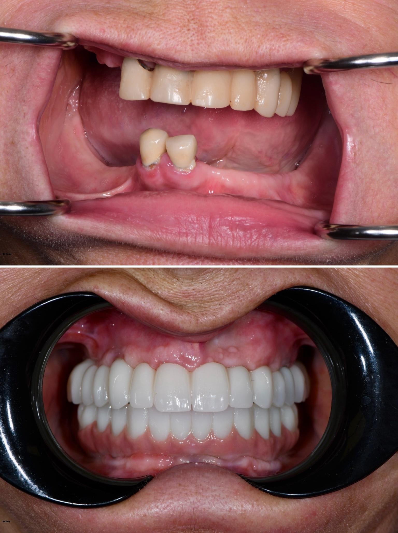 Empower Dental Pasadena Image