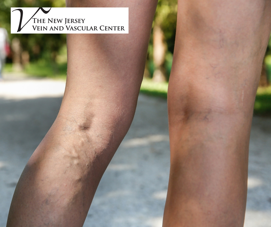 The New Jersey Vein & Vascular Center Photo