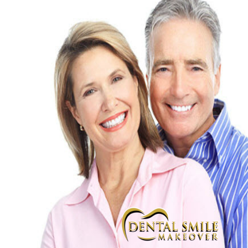 Dental Smile Makeover Photo