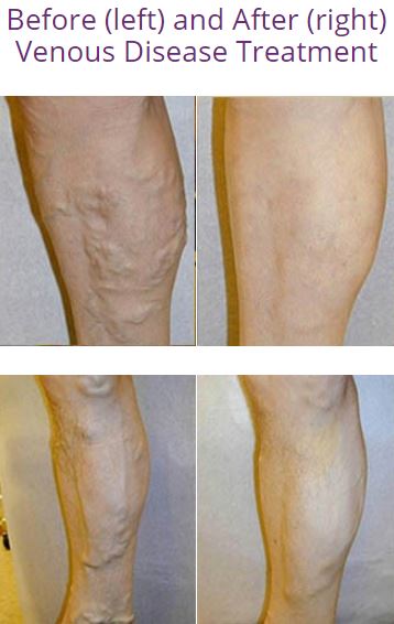 Providence Vein Center Photo