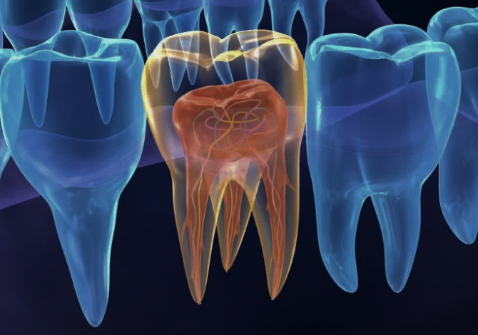 Root Canal Treatment