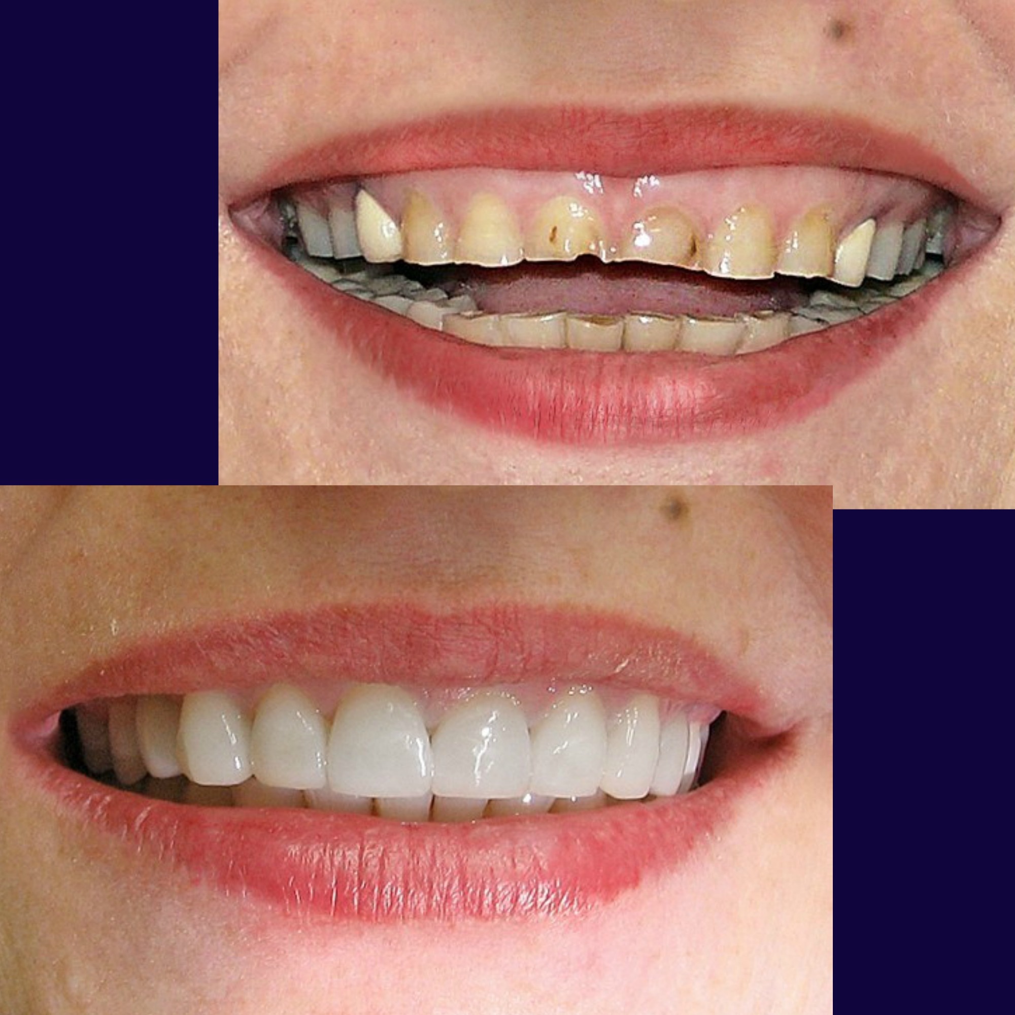 Guest smile coupon code