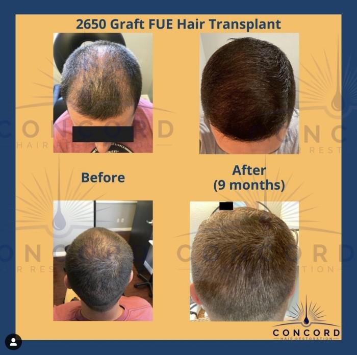 Concord Hair Restoration & Wellness