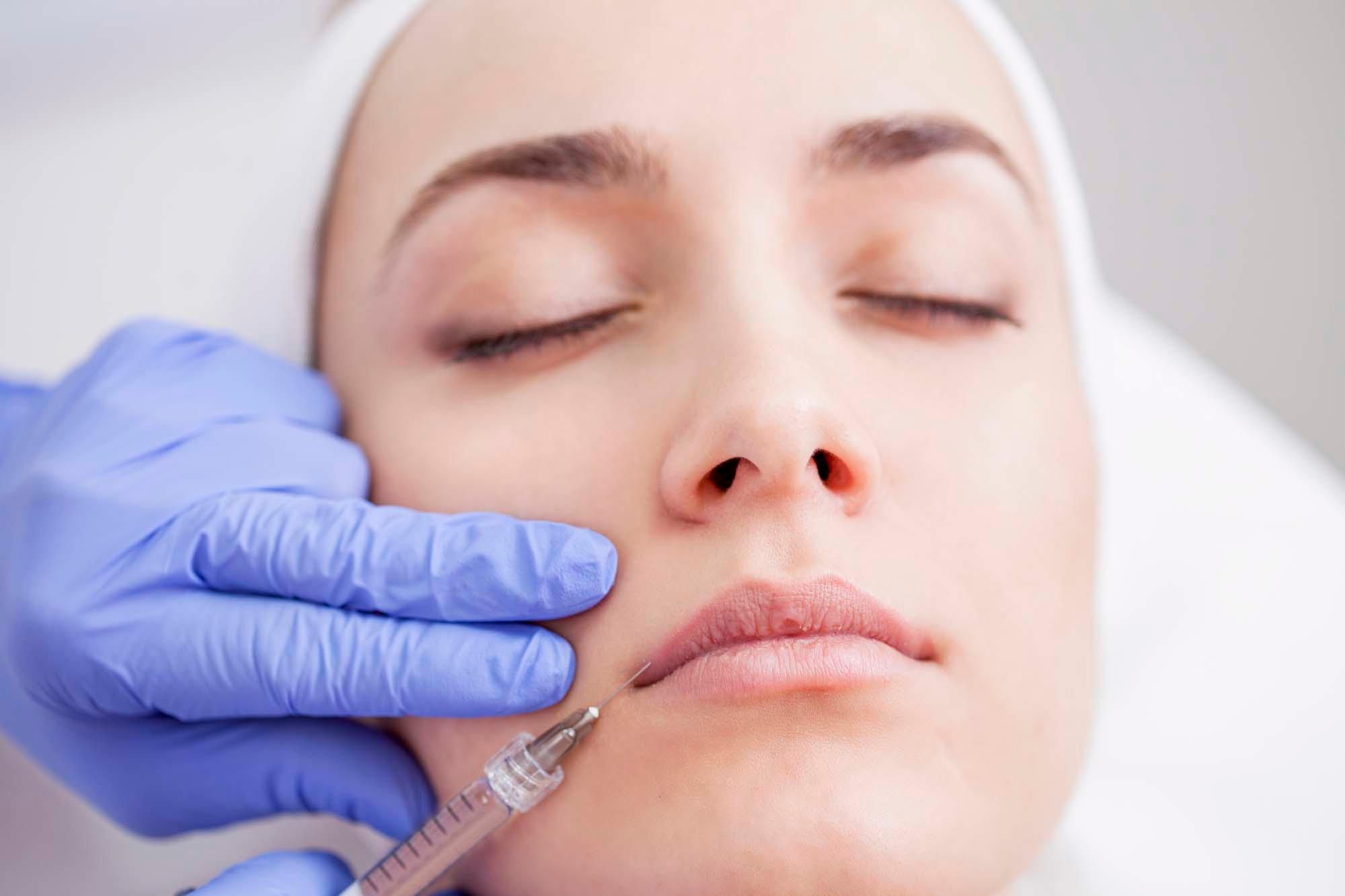 FACIAL (DERMAL) FILLERS