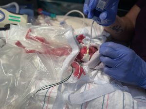 Photo of newborn Seiori Sweeney Austin who was born at only 23 weeks and 2 days and weighed just 12 oz.