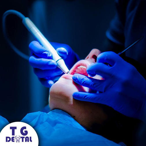 Images T.G. Dental
