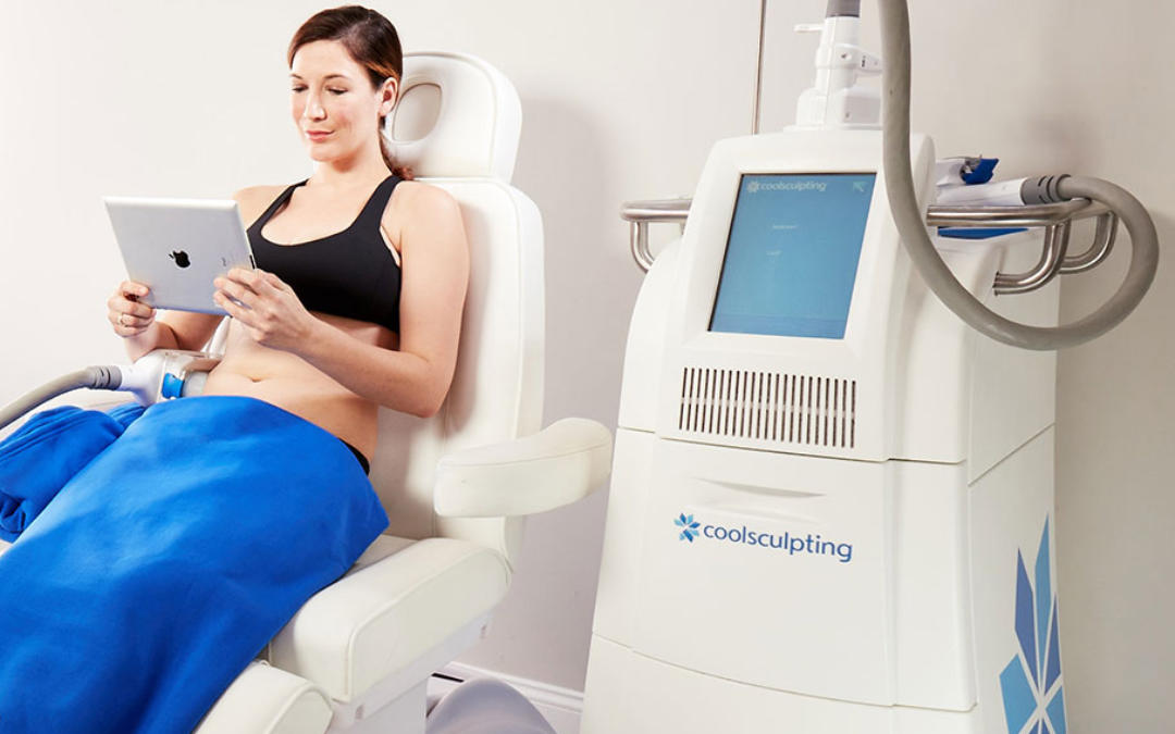 CoolSculpting