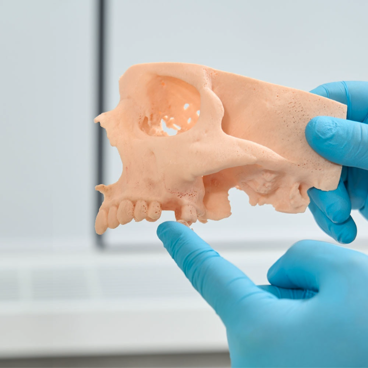 Bone Grafting