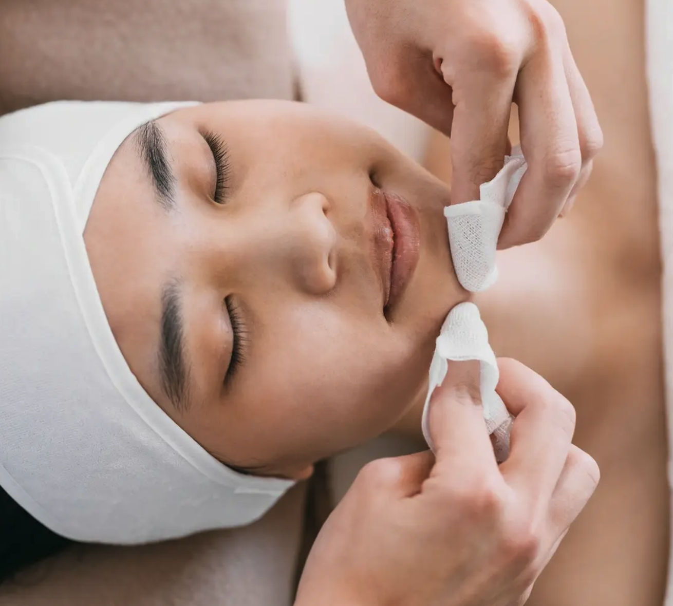 Chemical Peels