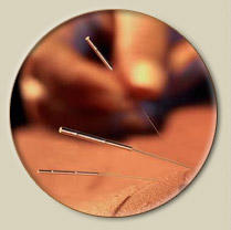 Marcy Wilson Acupuncture Photo