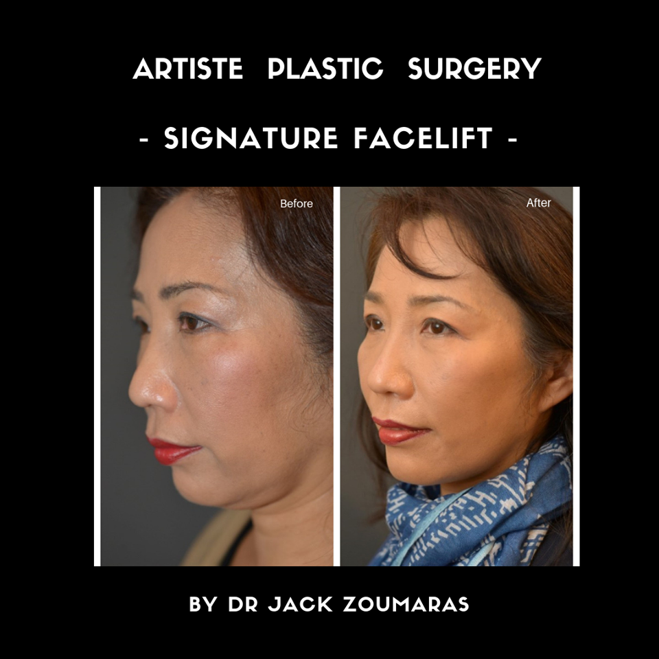 Images Artiste Plastic Surgery - Dr. Jack Zoumaras