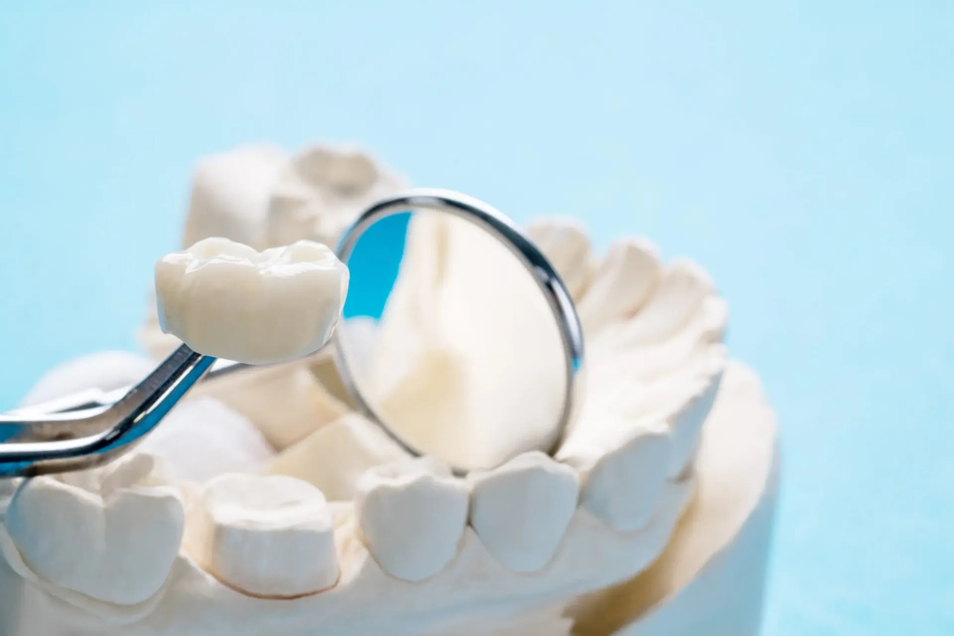 Keramik - Kronen und Veneers