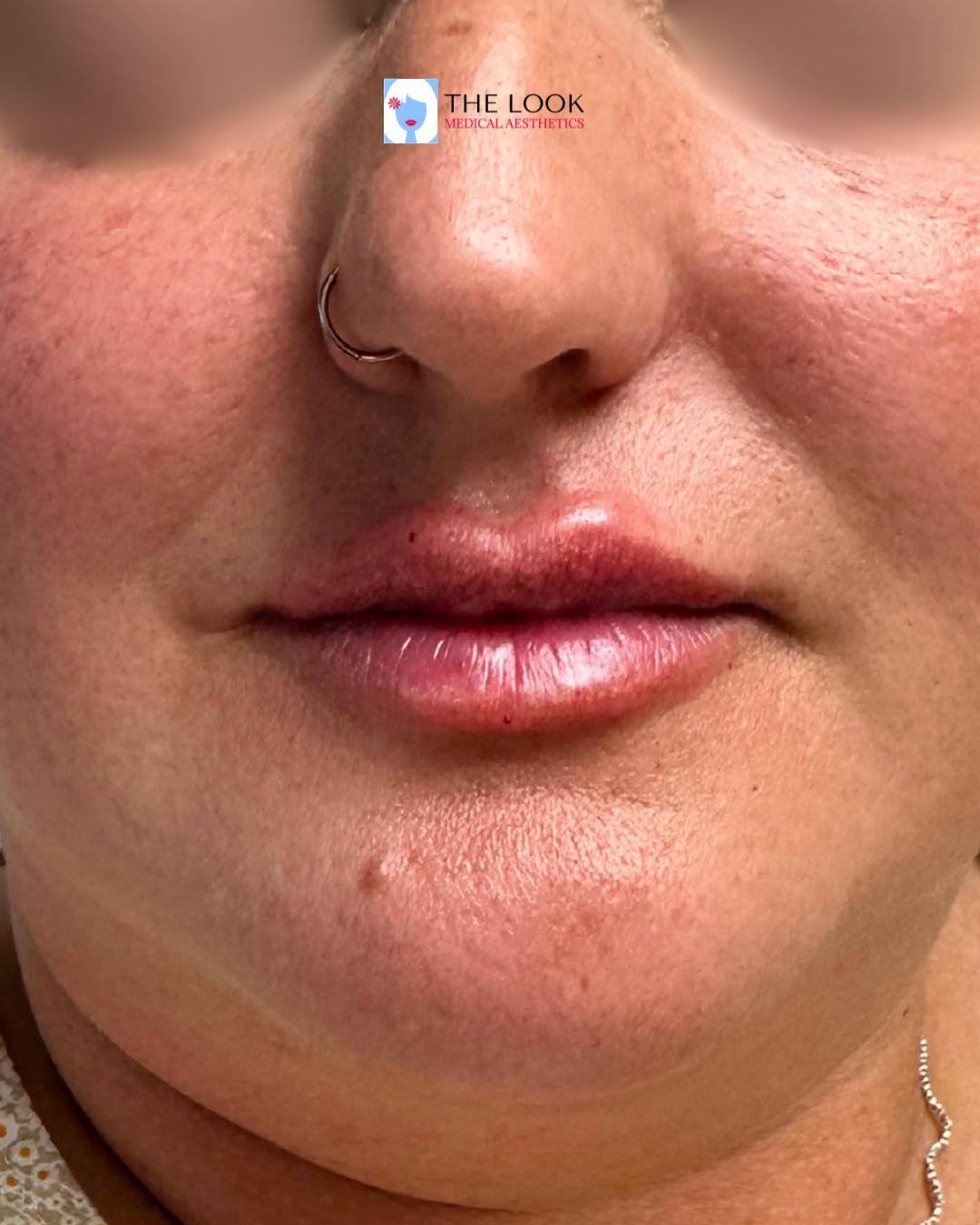 The Look Medical Aesthetics