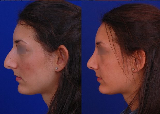 Images Visage Facial Plastic Surgery