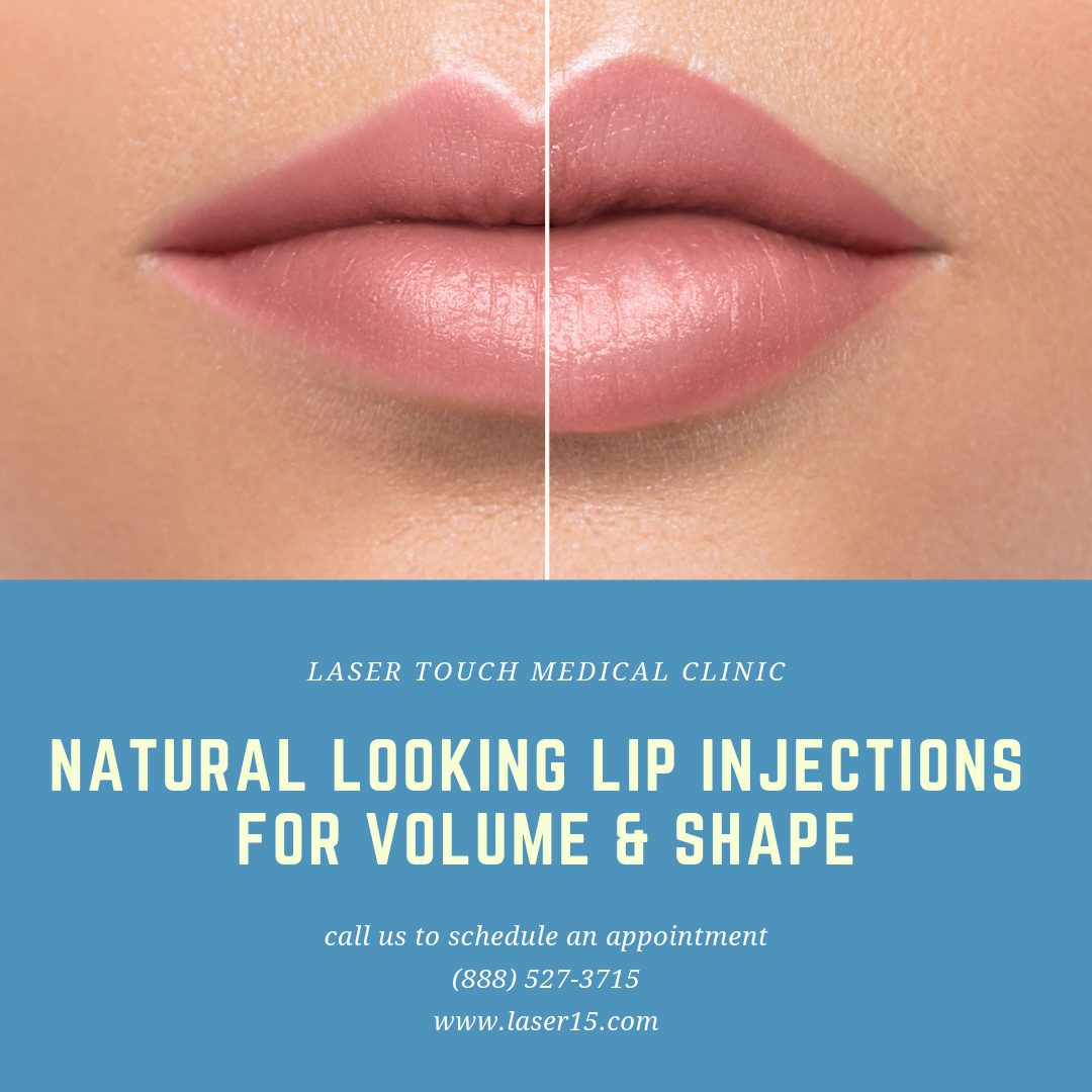 At Laser Touch Medical Clinic, Dr. Hakimian offers non-surgical lip treatments as a great way to change the appearance of your lips and mouth without surgery.