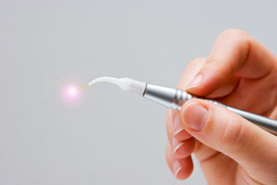 Laserbehandlung
