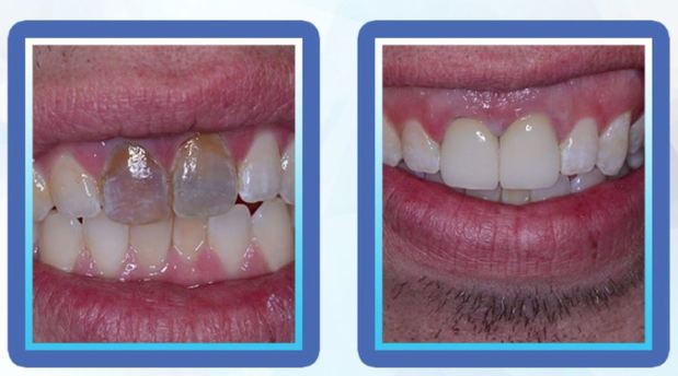 Images Max L Lingo, DDS