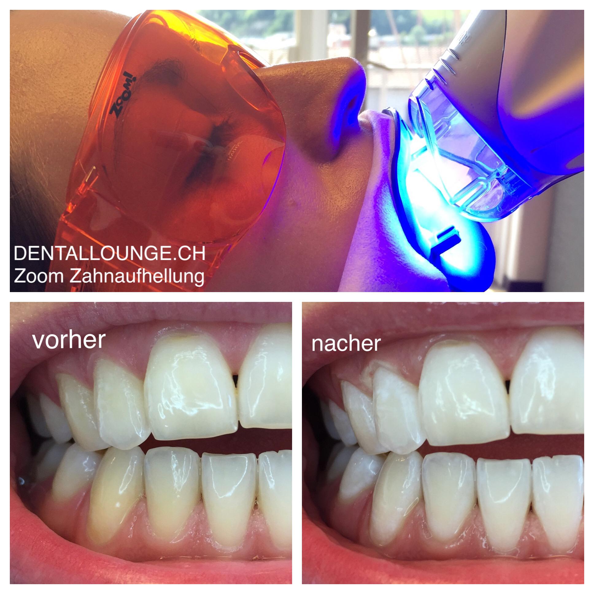 Dentalhygiene Tschan Claudia