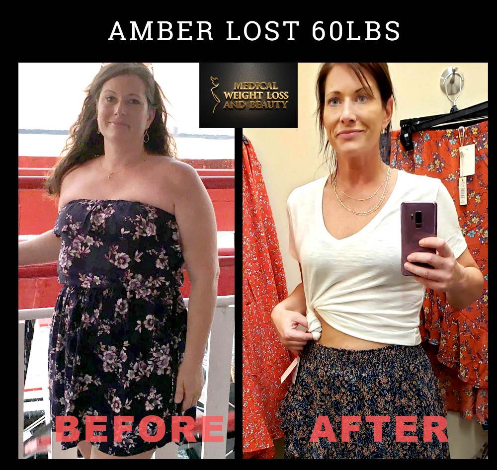 Medical Weight Loss and Beauty Image