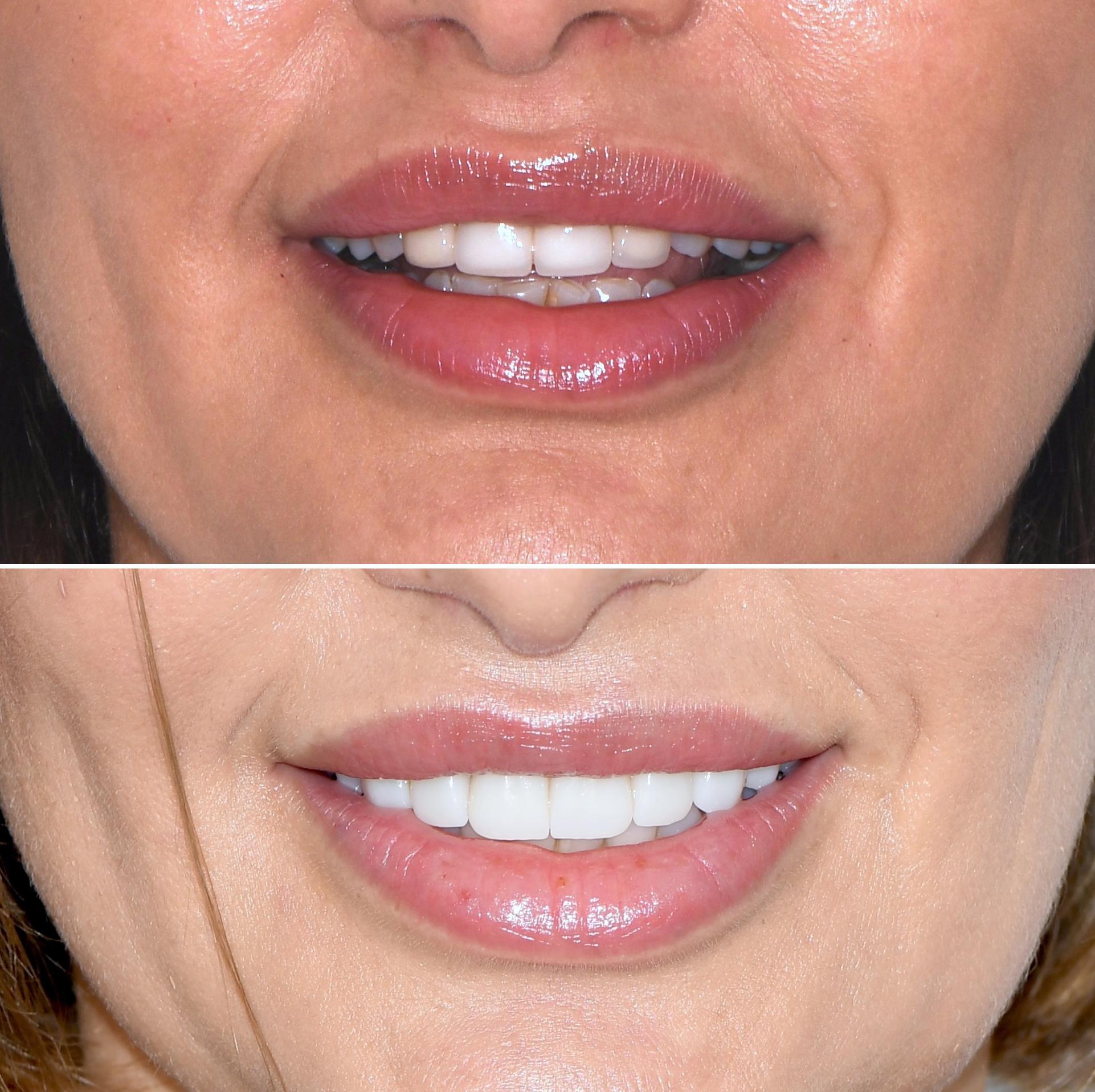 Empower Dental Pasadena Image