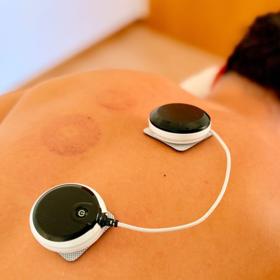 Électrostimulation