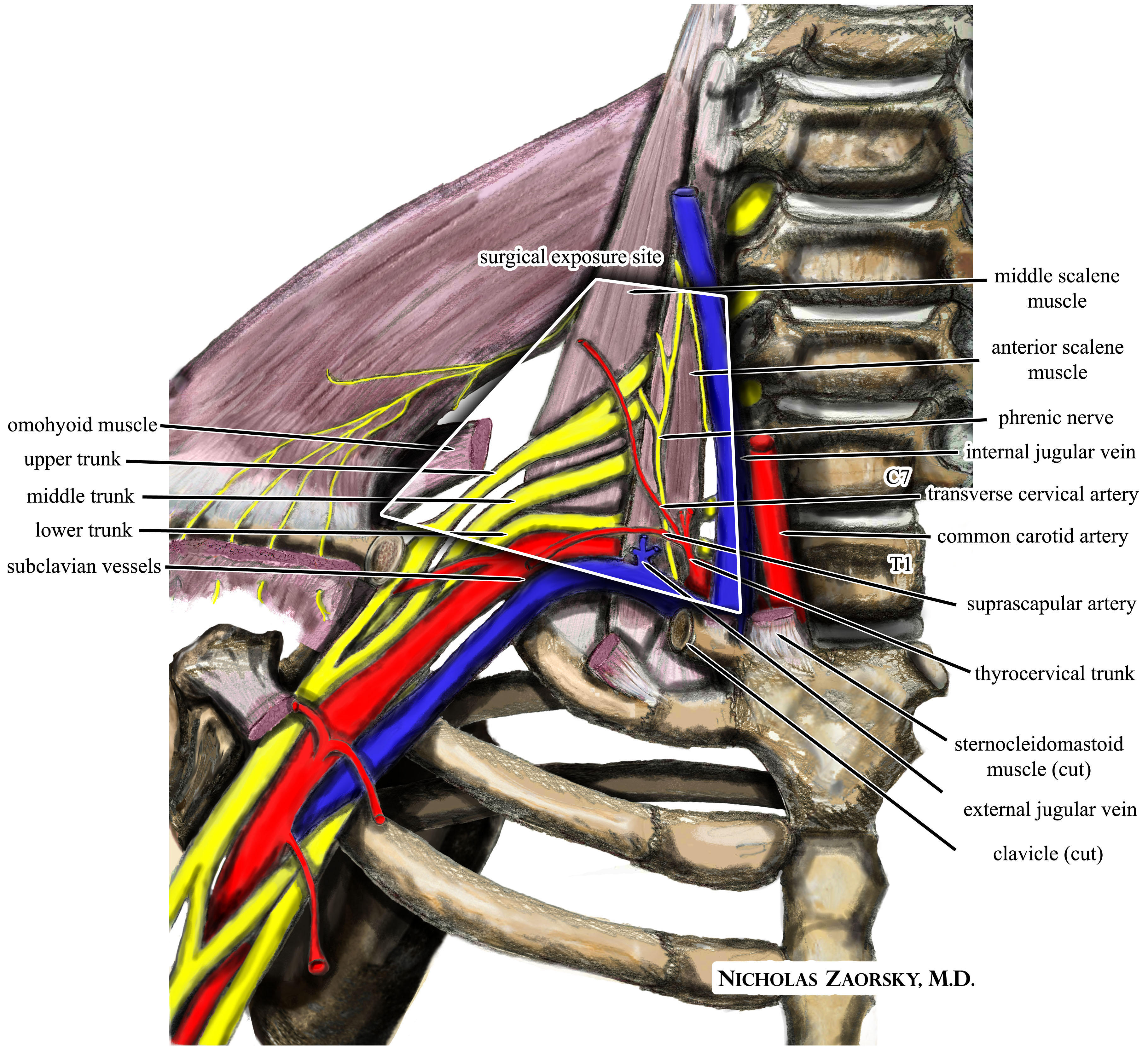 Thoracic Outlet Syndrome is a term that describes the abnormal compression, injury or irritation of the nerves and blood vessels between the lower neck and upper chest area. This injury can affect all ages and genders resulting from either repetitive injuries from work or sports, motor vehicular injuries, anatomical defects, poor posture or pregnancy. An individual with TOS may experience various symptoms depending on which structures are compressed, but common signs and symptoms include numbness or impaired circulation at the neck, shoulders and arms. They also may experience aches in the neck, shoulders and hands, arm pain and swelling, numbness and tingling sensation in the fingers and discoloration of the hands (Bluish). Thoracic Outlet Syndrome is treatable. If TOS is left untreated, complications could occur such as permanent arm swelling, permanent nerve damage or blood clots. If an individual continues to experience any of these signs or symptoms, they should be seen by a specialist in the field of Electrodiagnostic Medicine, http://emg-ncv.com, (EMG/NCS). For additional information, you can contact California Sports & Rehab Center. We can accommodate your needs in multiple locations in the Los Angeles and Orange County areas. Please visit us at http://emg-ncv.com or call our office at (310)-652-6060 for any questions!