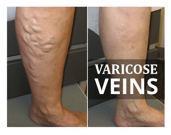 Images Vein Expert