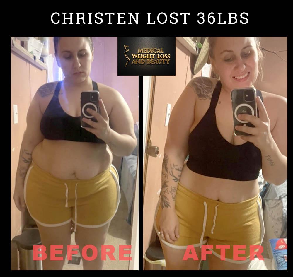Medical Weight Loss and Beauty Image