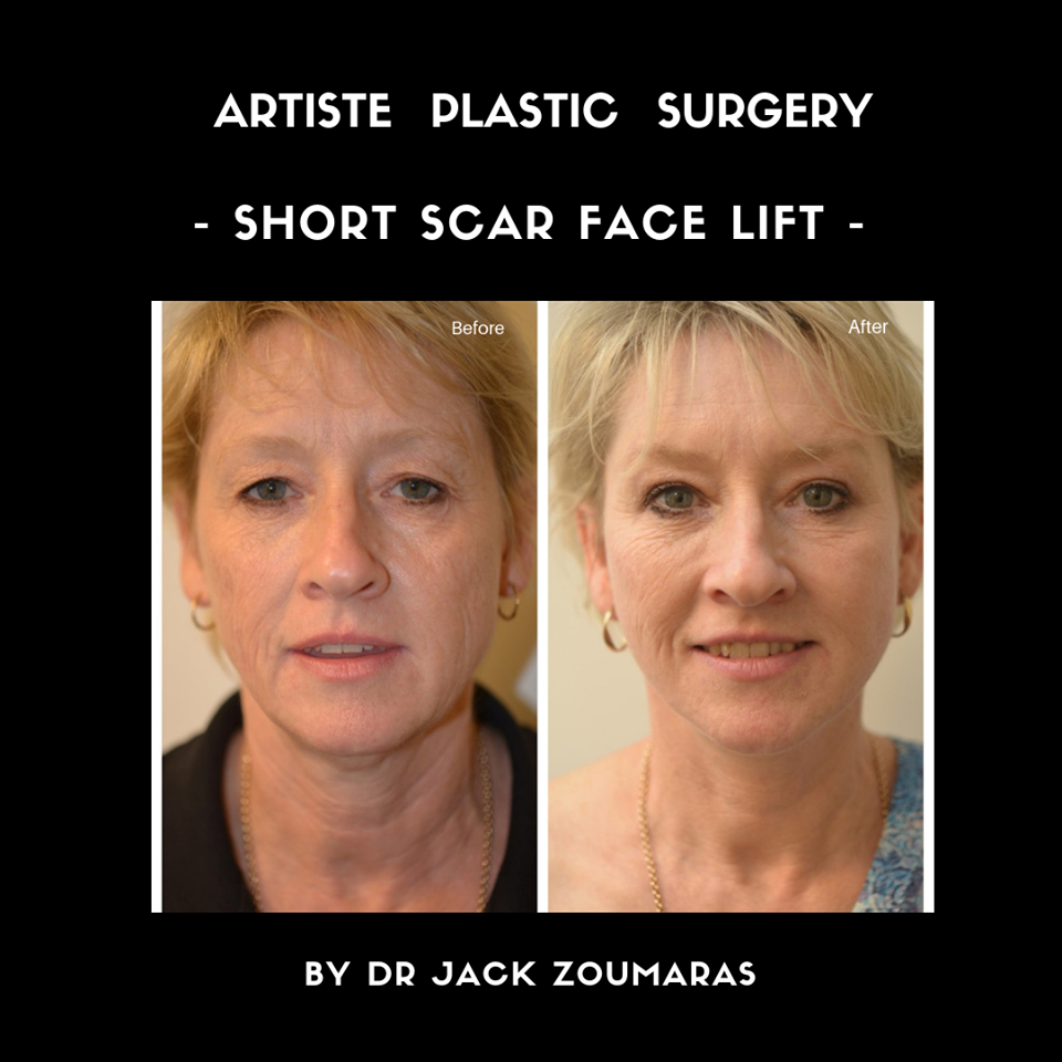 Images Artiste Plastic Surgery - Dr. Jack Zoumaras